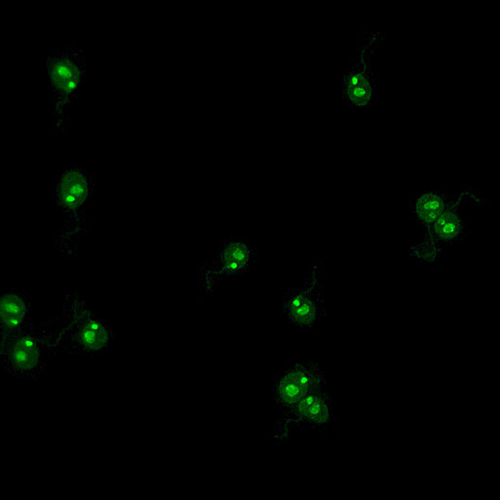 Anti ds DNA Antibody IFA